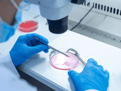 CAR-T Cell Therapy
