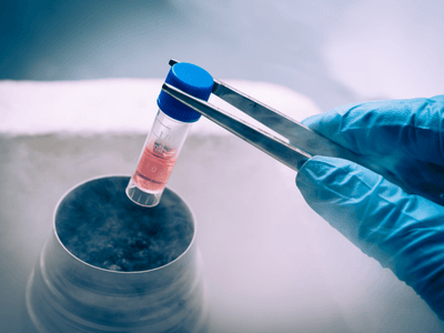 MSCs (Mesenchymal Stem Cells)