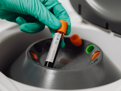 Plasmapheresis